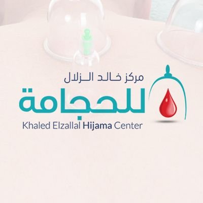 مركز خالد الزلال للحجامة